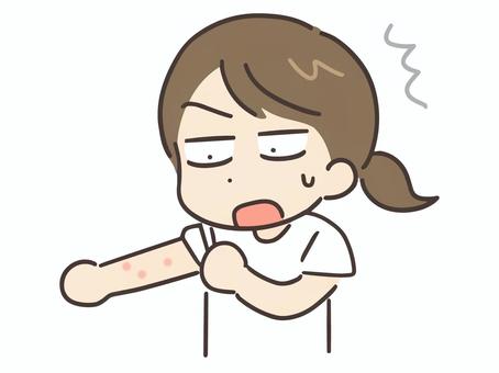 2026年4月健康新聞～蕁麻疹について～